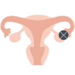 ピル作用・排卵抑制